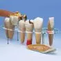Enlarged dental prosthetics set W42529