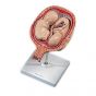 Development of twin fetuses in fetal position 5th Month L10/7
