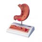 Stomach with Ulcers model K17