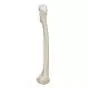 Femur, right A35/1R