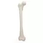 Femur, right A35/1R