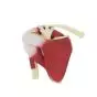 Mediprem shoulder-joint