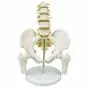 Pelvis with lumbar vertebrae and femur head 5 pieces