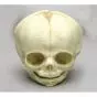 Fetal skull 30 weeks Erler Zimmer