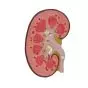 Mediprem kidney model, 1.5 times life size