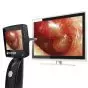 Rigid video endoscope / with speculum / with integrated video monitors Otoscreen 2 Spengler