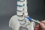 Standard spine with prolapse and pelvis