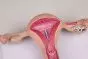 Life size uterus model Erler Zimmer