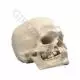 Microcephalic Human Skull A29/1