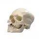 Human Skull with Cleft Jaw and Palate A29/3
