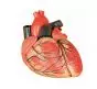 Mediprem enlarged heart model 3 parts