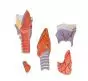 Mediprem larynx model enlarged in 5 pieces