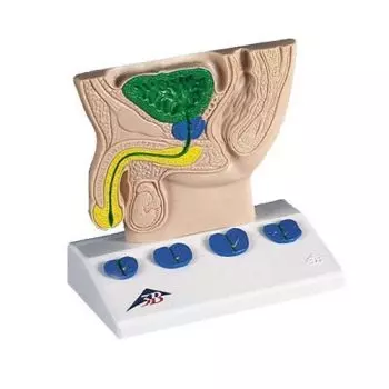 Prostate Model (schematic) K40