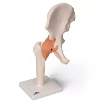 Functional Hip Joint A81