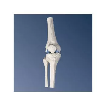Mini Knee Joint A85
