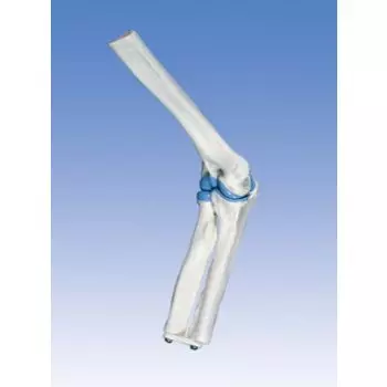 Mini Elbow Joint A87