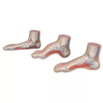 MEDart™ Foot Series – Normal, Flat and Hollow Feet MAM33