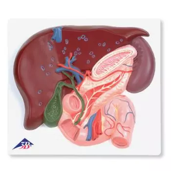 Liver with Gall Bladder, Pancreas and Duodenum VE315