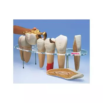 Dental Morphology Series, 7 part, 10 times life size - German W42528