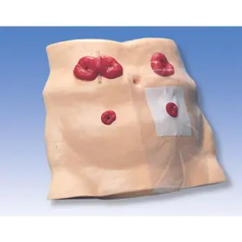 Ostomy Care Model W43027