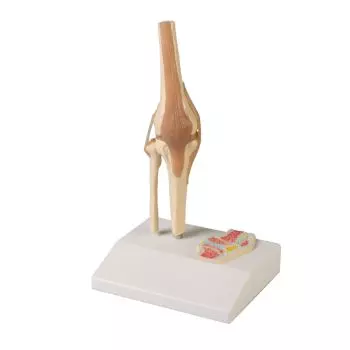 Miniature knee joint with cross section Erler Zimmer