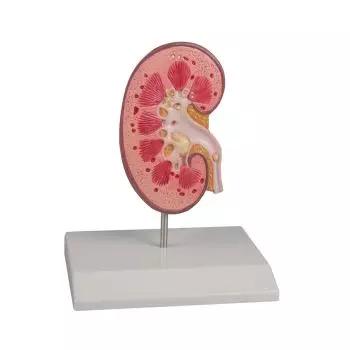 Kidney Stone Model real life size Erler Zimmer