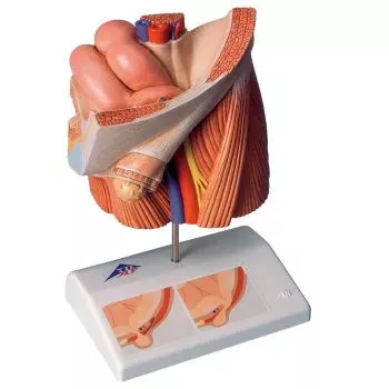 Inguinal hernia model H13