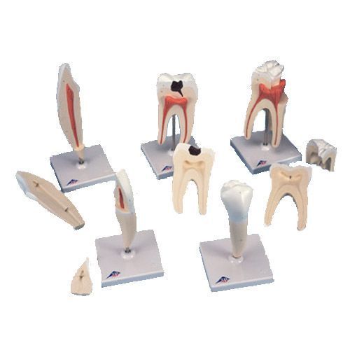 Set of 5 tooth models D10