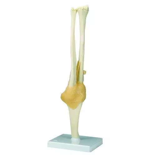 Functional Elbow Joint A83