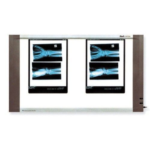 Double panel LCD X Ray Viewer (45W)