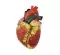 Mediprem enlarged heart model 3 parts