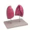 Mediprem left and right lung model enlarged 1.5 times