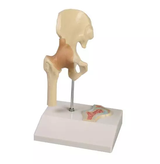 Miniature hip joint with cross section Erler Zimmer