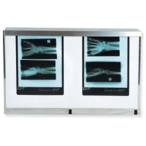 Double panel standard X Ray Viewer with switch, 54W
