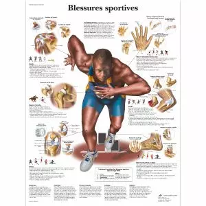 The anatomical sports injury poster VR2188UUU