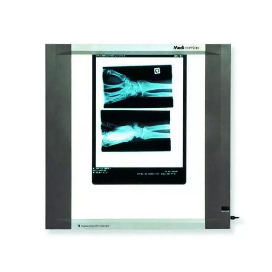 Single panel LCD X Ray Viewer (22W)