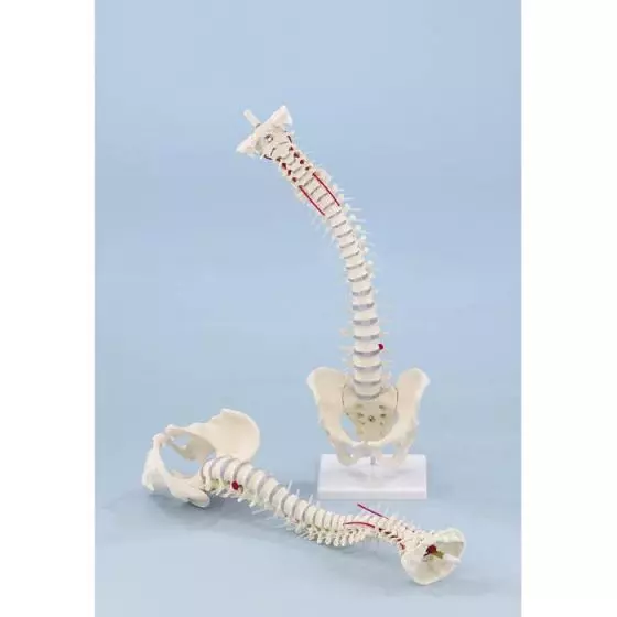 Standard spine with prolapse and pelvis