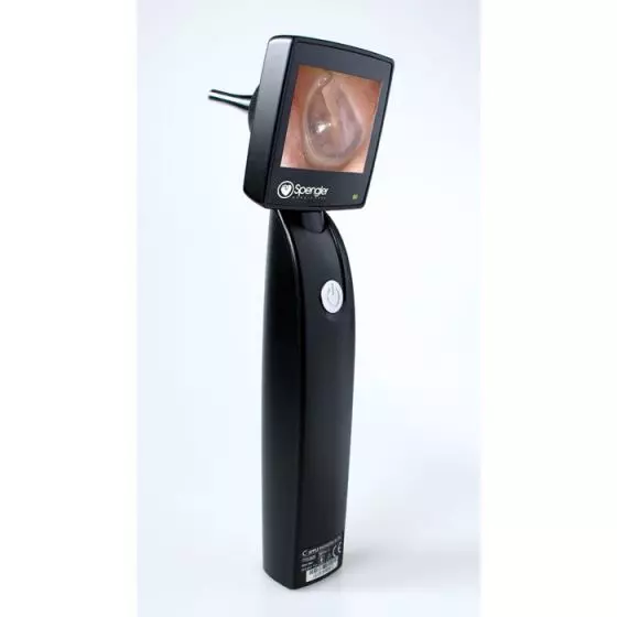 Rigid video endoscope / with speculum / with integrated video monitors Otoscreen 2 Spengler